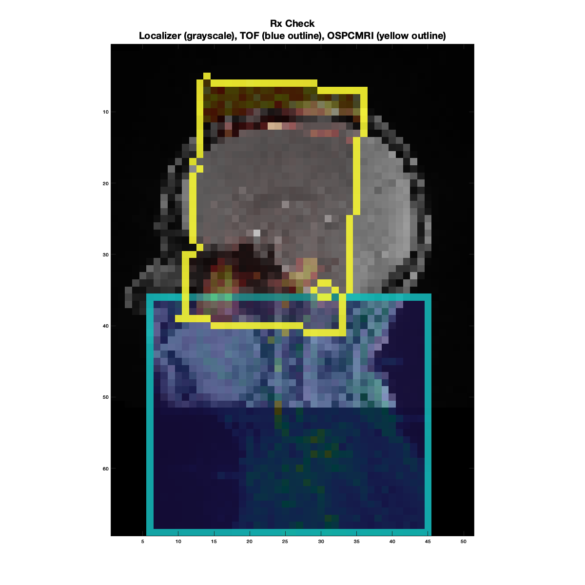 ../_images/20250923_OSPCMRI_CheckRx_Bad1.png