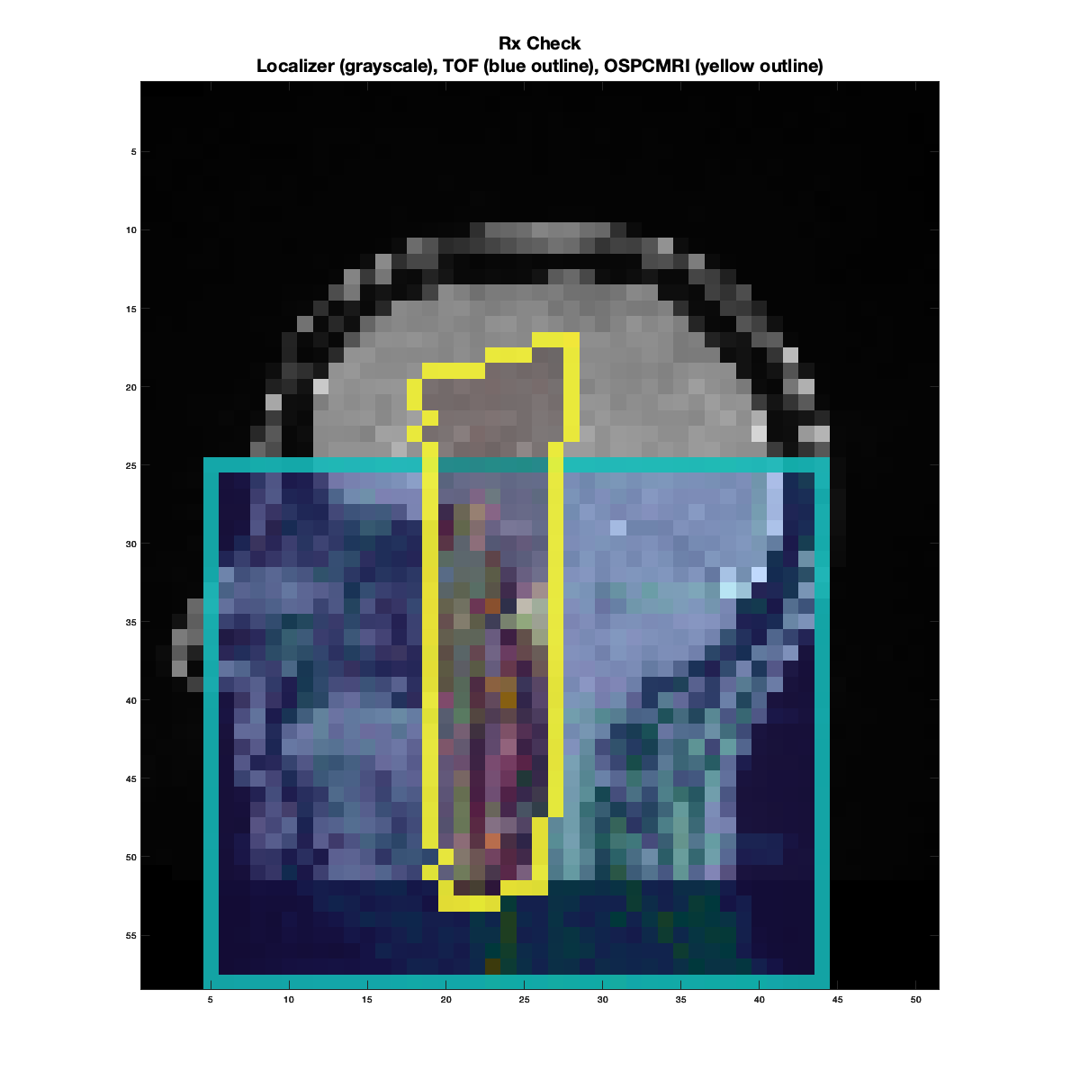 ../_images/20250923_OSPCMRI_CheckRx_Bad2.png