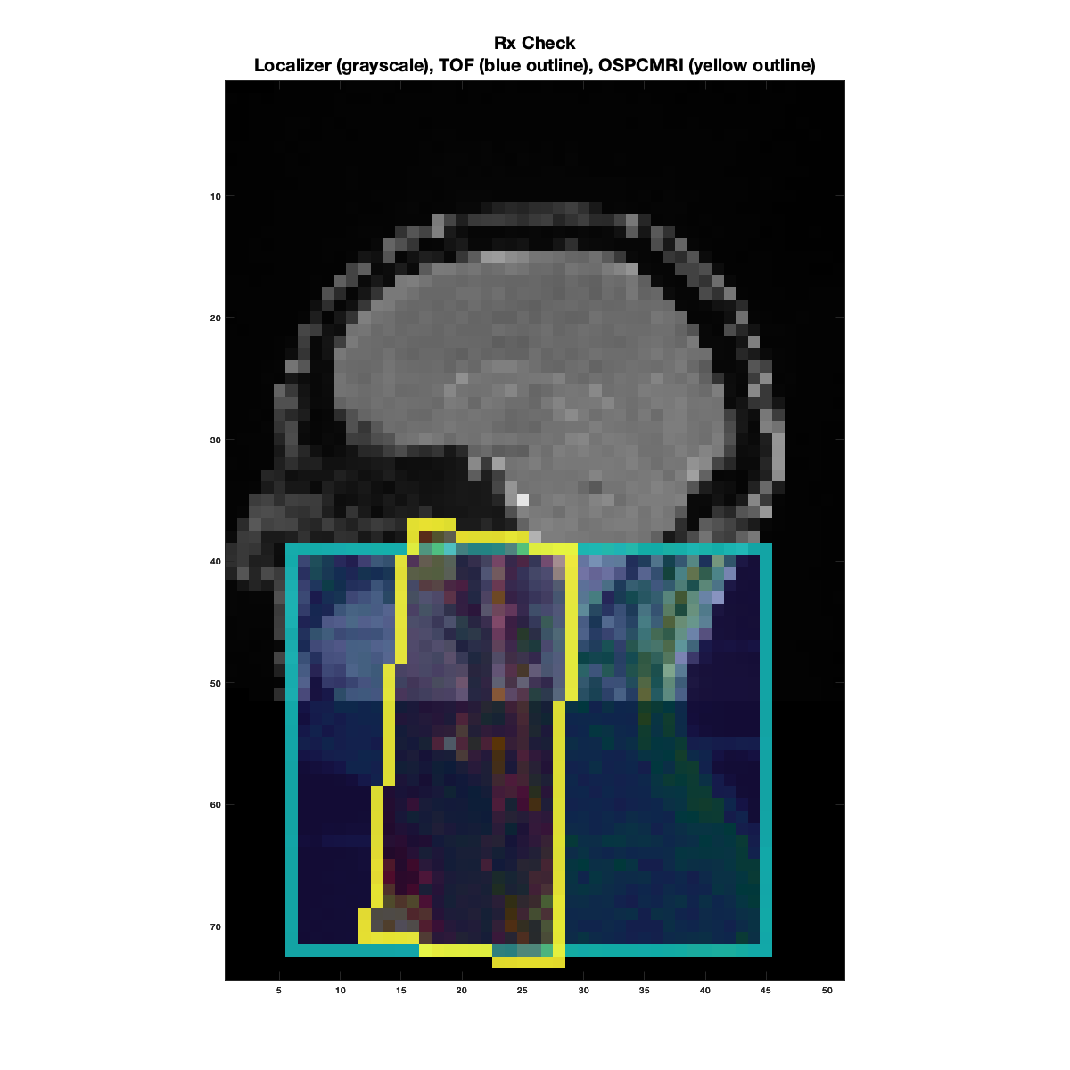 ../_images/20250923_OSPCMRI_CheckRx_Good.png
