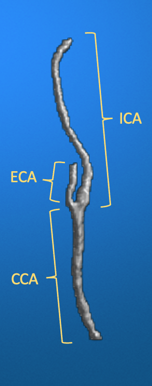 ../_images/20250923_OSPCMRI_TOFMaskingExample_Segments.png